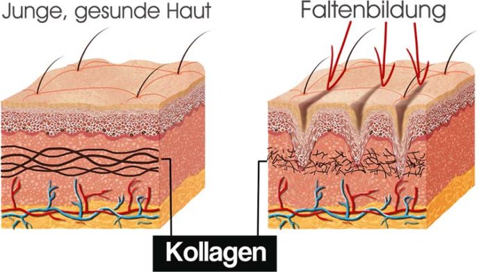 Kollagen und Faltenbildung